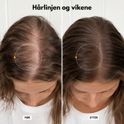 Korea #1 Hårvekst serum