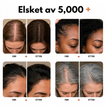 Korea #1 Hårvekst serum
